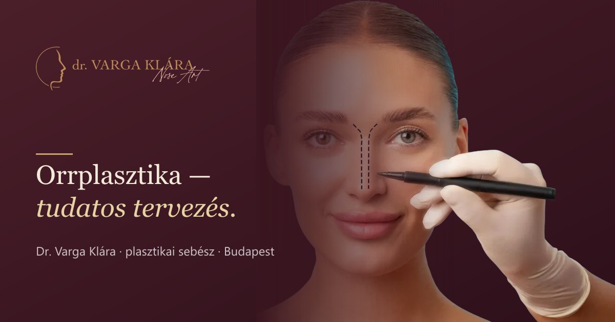 Preview image published by vargaklara.hu