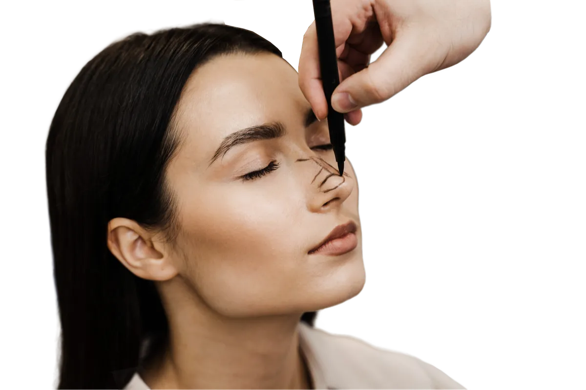 Pre-operative markings on the nose during specialist planning